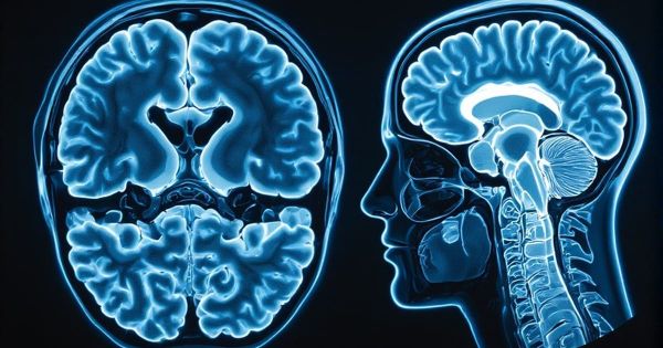 MRI brain scan showing front view and side profile in clinical blue