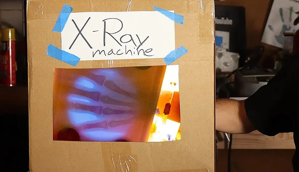 Engineer Builds His Own X-Ray After Hospital Charges Him $69K