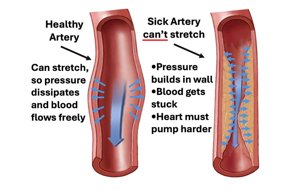 The Great Dangers of Blood Pressure Medications
