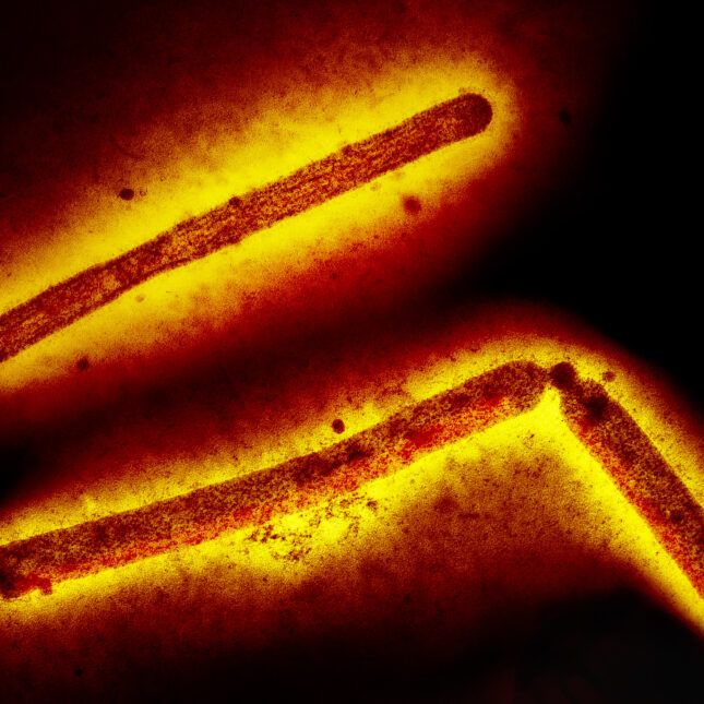 Finland to offer bird flu vaccine to select groups of people, a possible global first--but will they tell the human subjects that 5x as many people who got the Audenz bird flu vaccine vs placebo died?