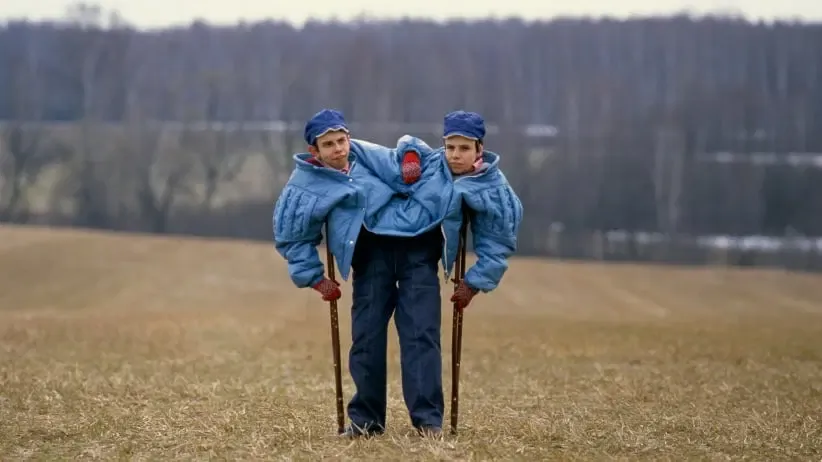 The Wonder Twins – Six Examples of Co-Joined Twins That Calls Into Question Germ Theory and "Viruses"