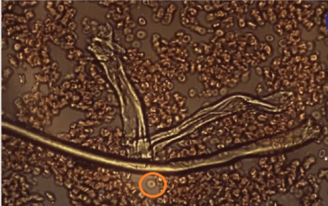 RETRACTION: Confidential Pfizer Documents confirm Graphene Oxide is in the COVID Vaccines & here is how to remove it from your body