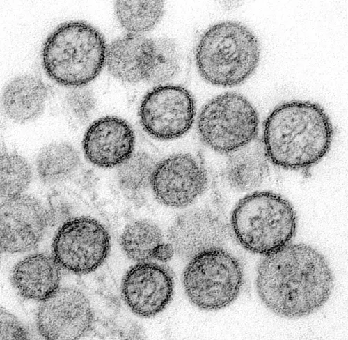 Hantavirus Hoax