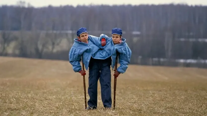 The Wonder Twins – Six Examples of Co-Joined Twins That Calls Into Question Germ Theory and "Viruses"