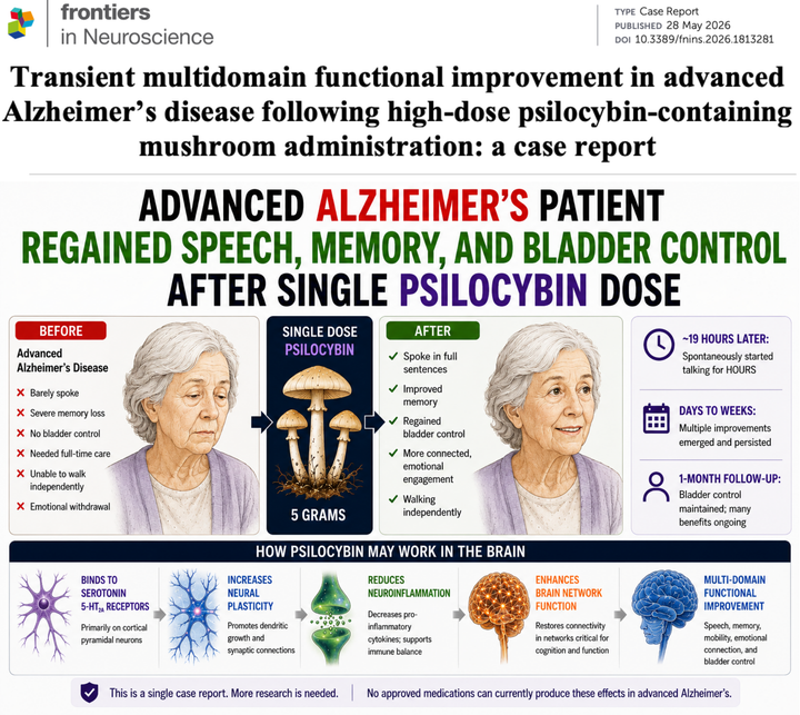 NEW STUDY: Advanced Alzheimer’s Patient Regained Speech, Memory, and Bladder Control After a Single Psilocybin Dose