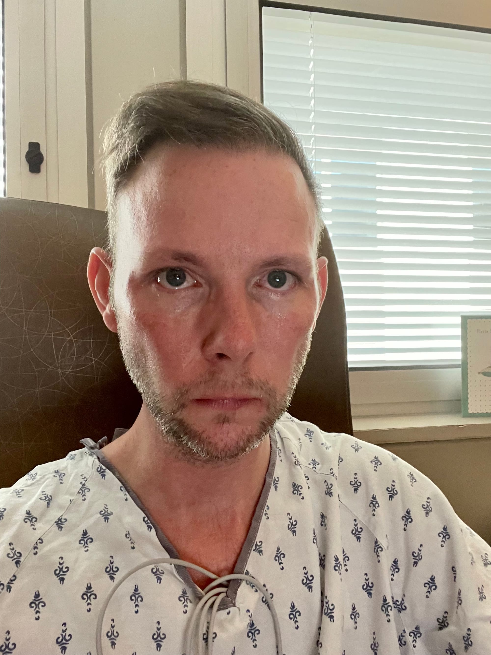 KP sitting in a hospital room in September 2021, wearing a hospital gown with monitor wires draped from the neckline. They look directly at the camera with a tired, determined expression while awaiting an HIV diagnosis.
