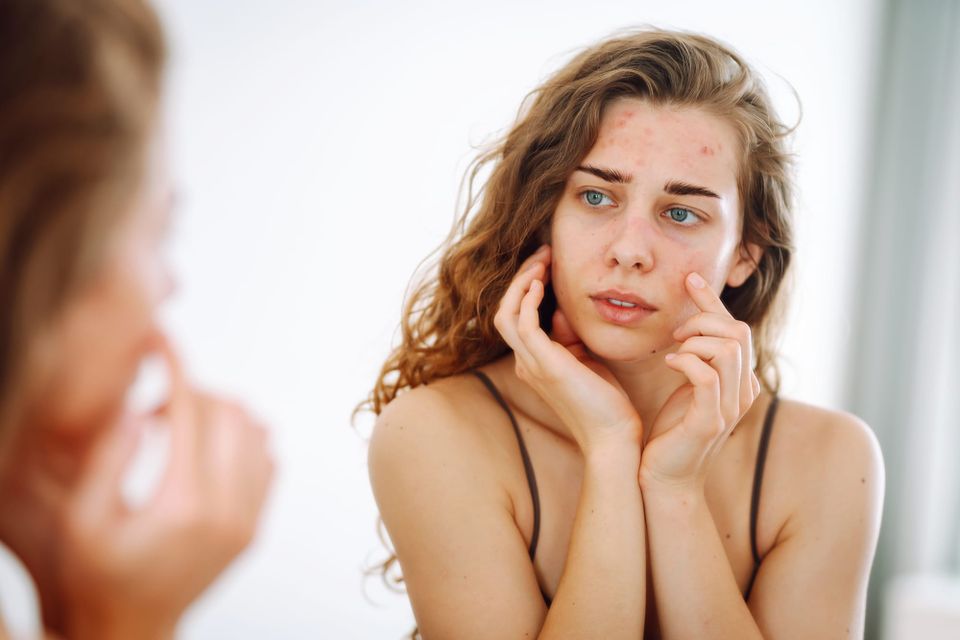 Skin-Deep Detox: Why Your Liver Health Is Written All Over Your Face