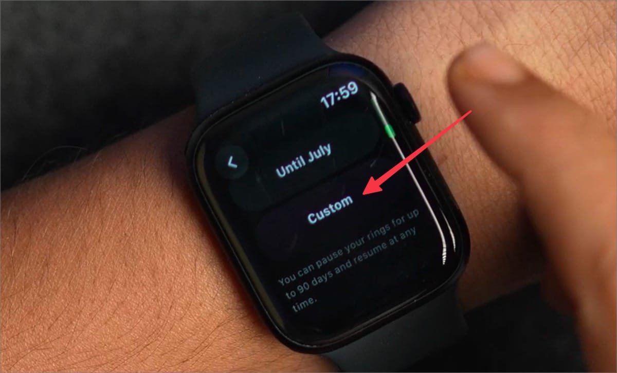 Custom&nbsp;button option