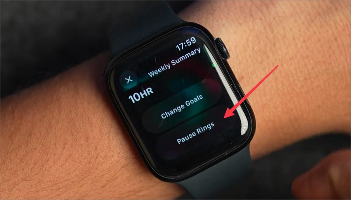 Pause Rings&nbsp;button