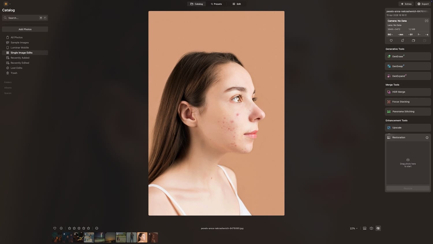 Girl with blemishes on face