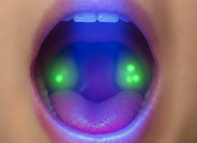 Light Device