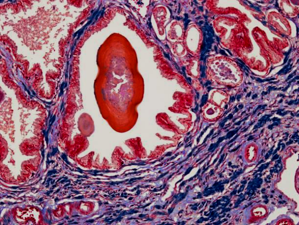 Prostate Health Explained: Key Facts Every Man Should Know