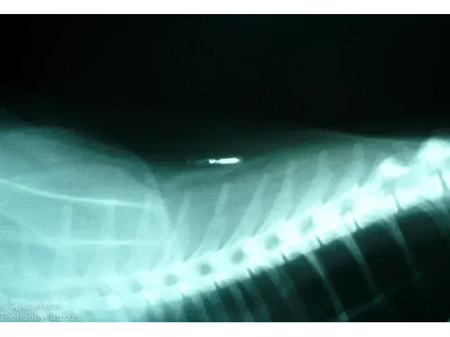 The Human Microchipped