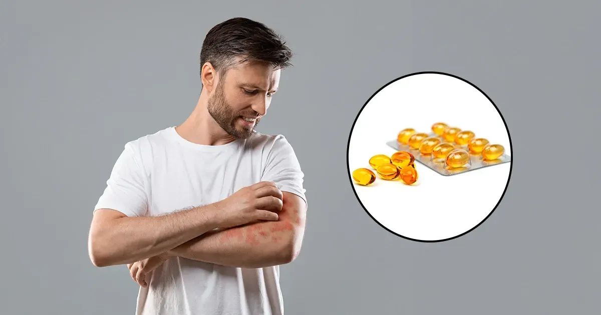 A relação entre a vitamina D e a psoríase