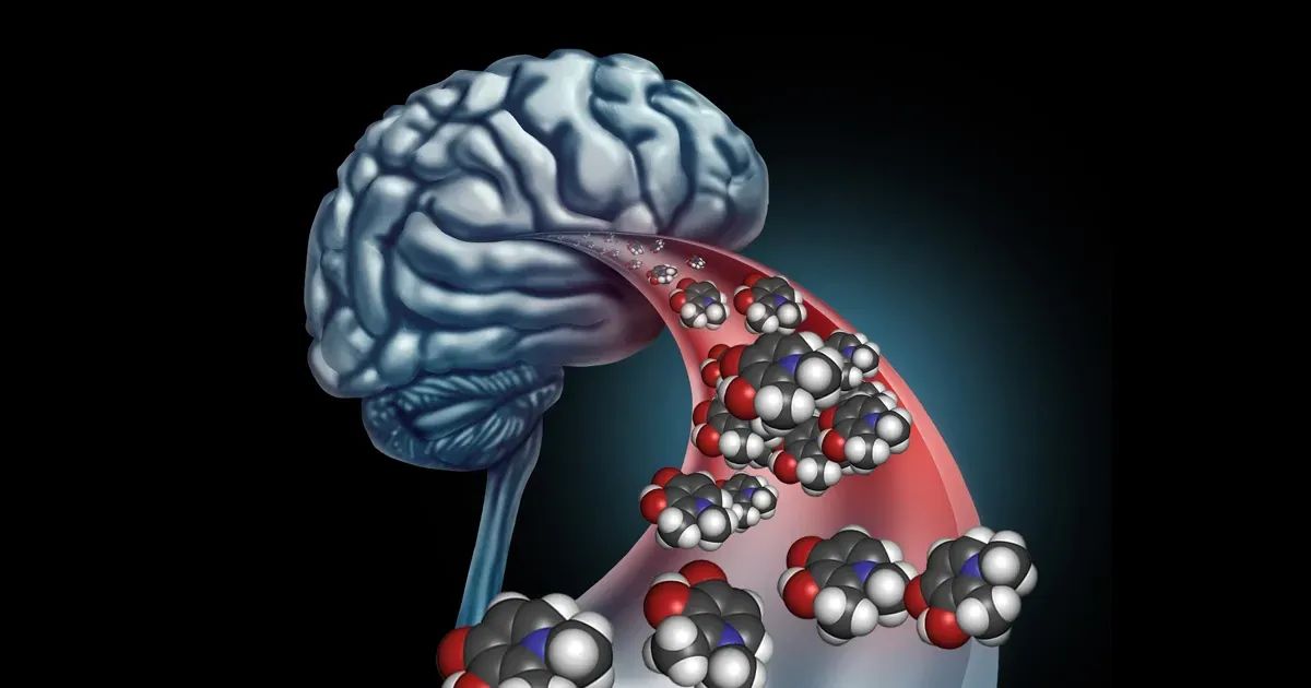 A relação entre a sobrecarga de ferro e a doença de Alzheimer