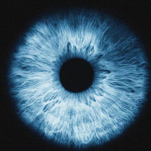 Singuläre Eskalation