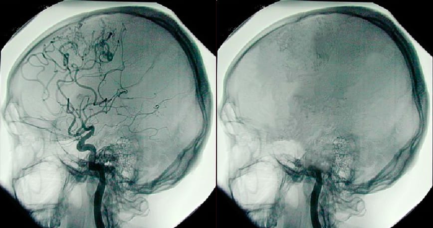 questioning brain death - Doctors Without Boredom