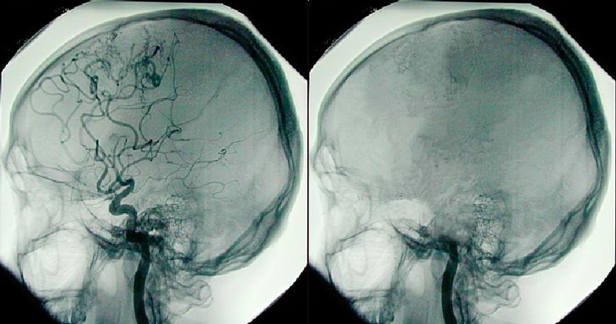 questioning brain death - Doctors Without Boredom
