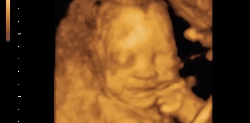 What's So Bad About Immodesty? - Mere Orthodoxy | Christianity, Politics, and Culture