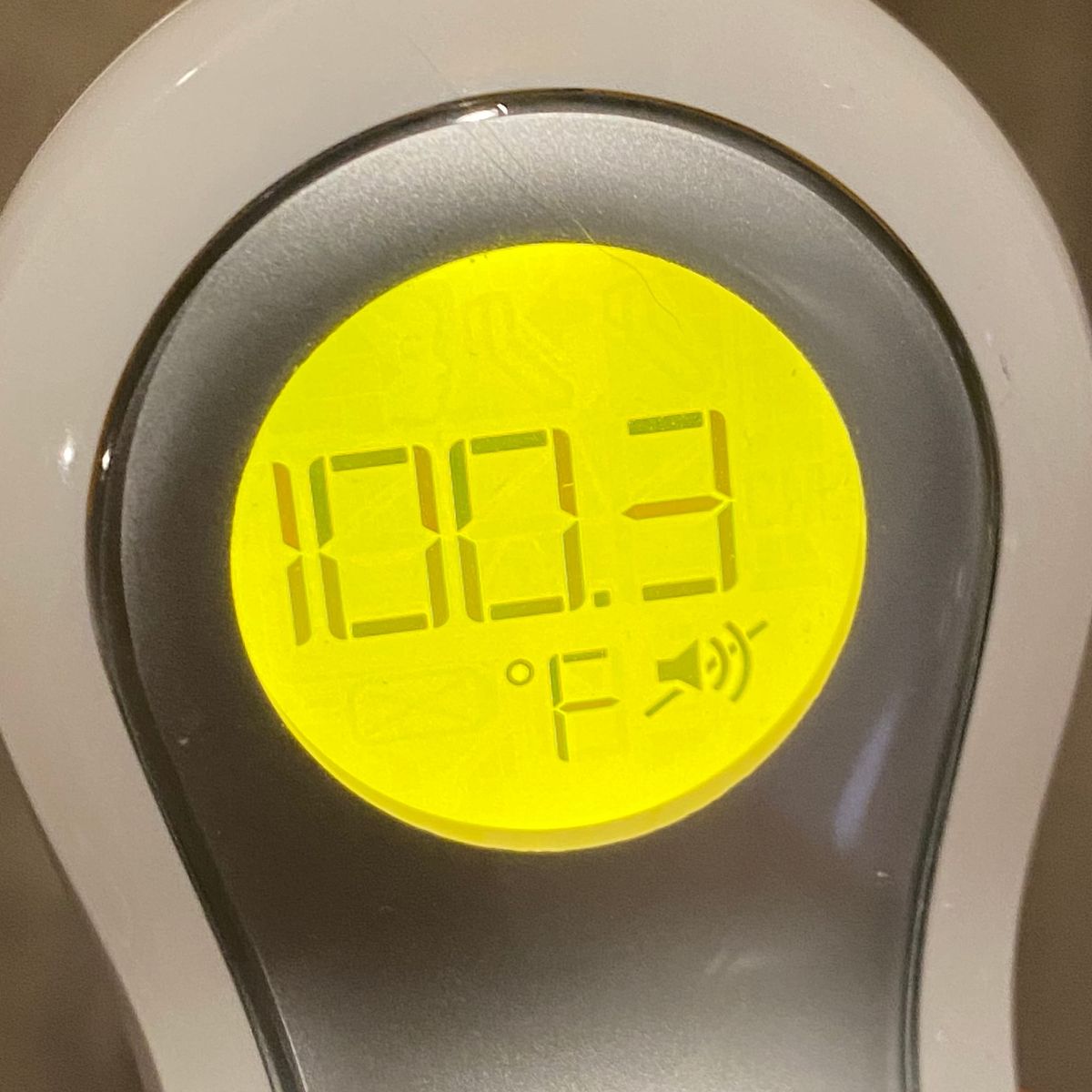 A digital thermometer indicating a temperature of 100.3 degrees Fahrenheit