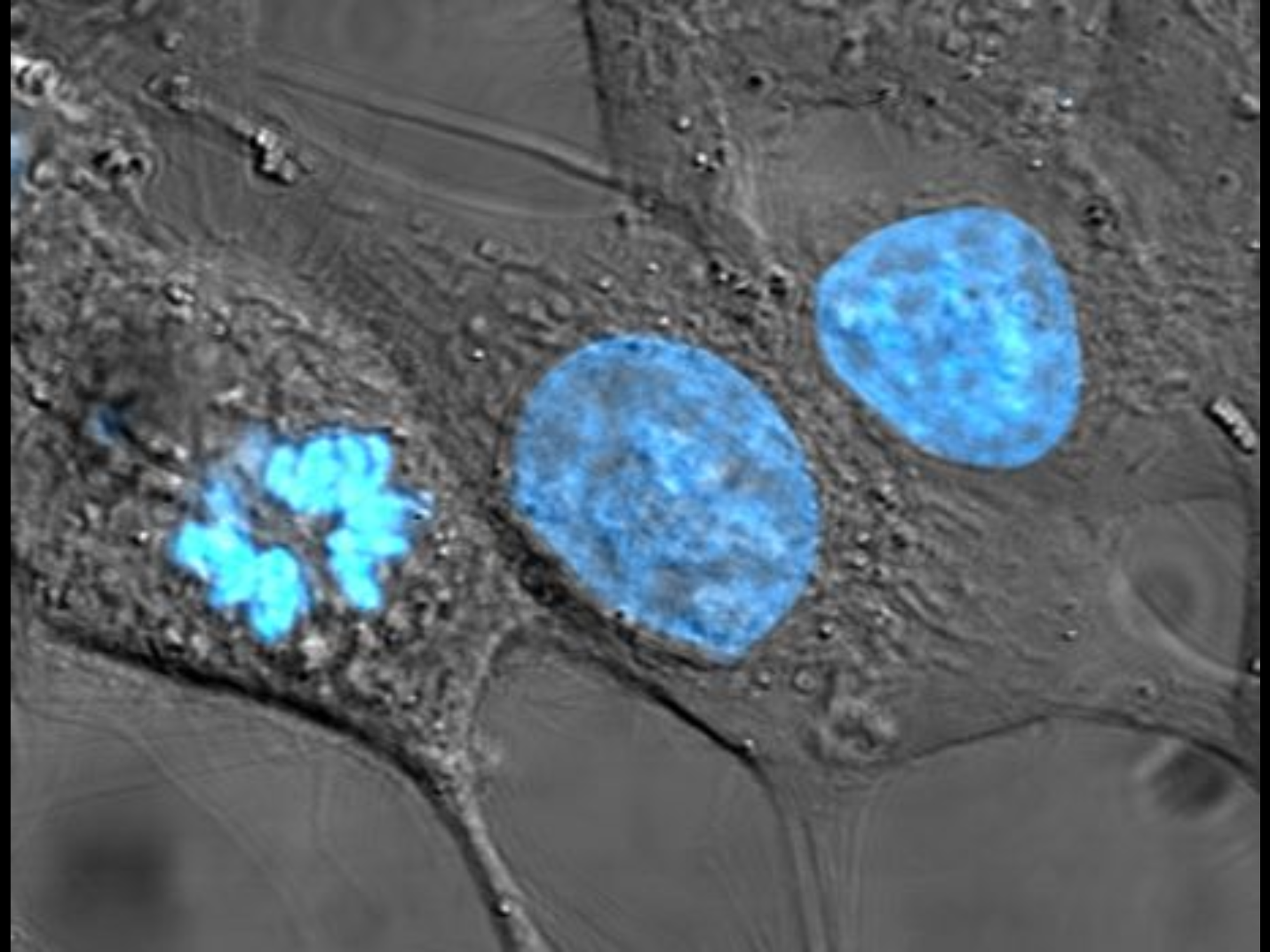 Discovery of Cell Nuclei