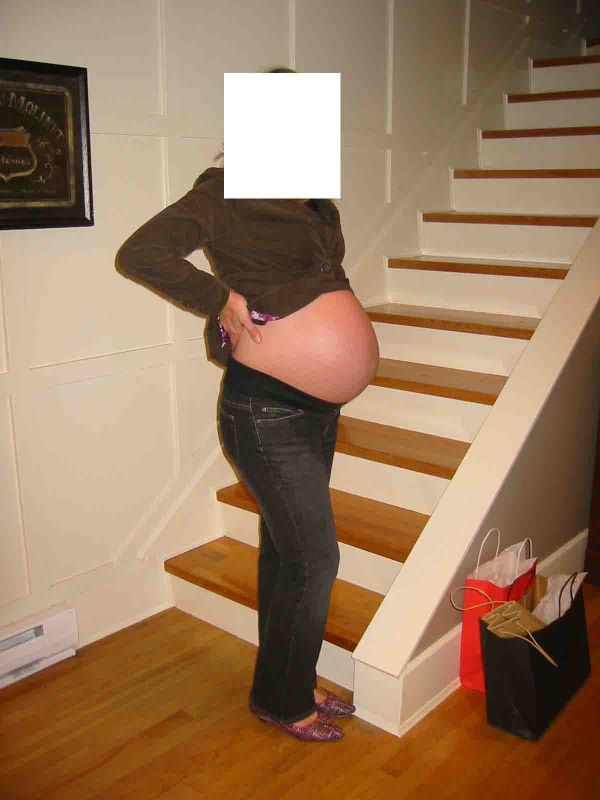 Katie"s bump - a discussion