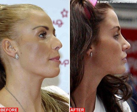 Becoming Victoria Beckham
