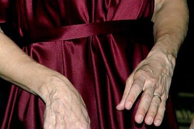 SJP: Dandy and her hands