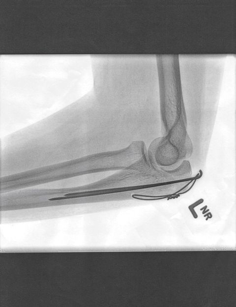 The Essence of Mischa Barton…