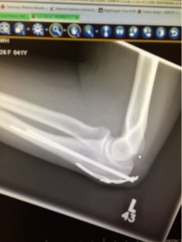 Intro for March 4, 2015