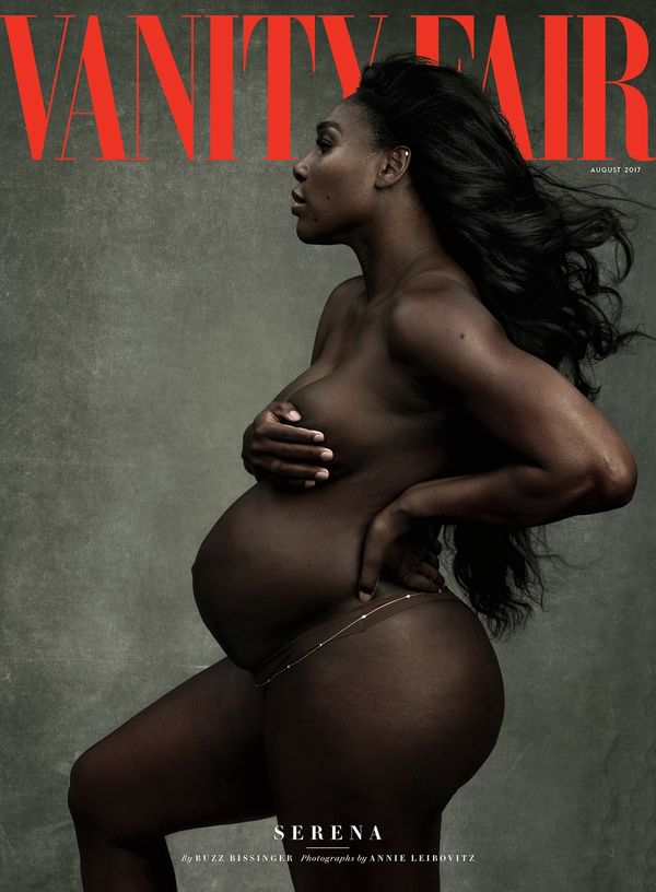 Serena Williams: Young, Gifted, Black, and Pregnant