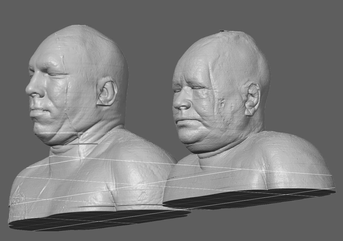 The Visible Human Project