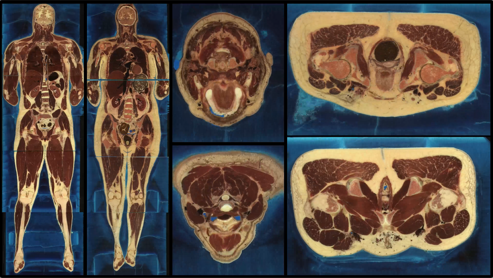 The Visible Human Project
