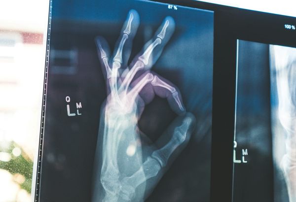 Gesundheit verbessern: Die wichtigsten Säulen