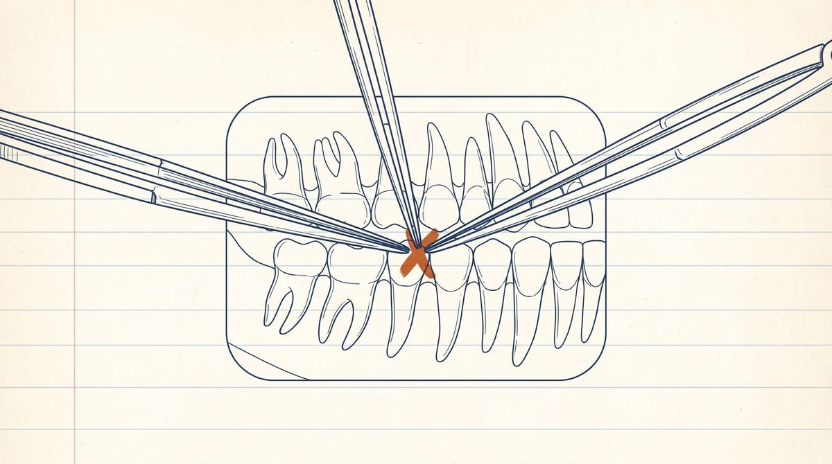 A dental bitewing radiograph drawn in ledger lines, measured by three rulers from three directions