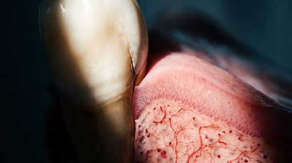 The junction between tooth and gum: the thin junctional epithelium with capillaries just beneath it