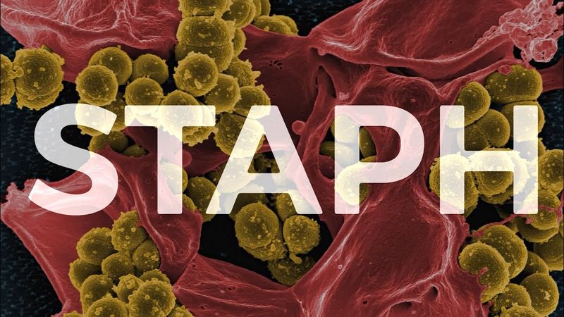 🦠 Why MRSA is so dangerous for grapplers