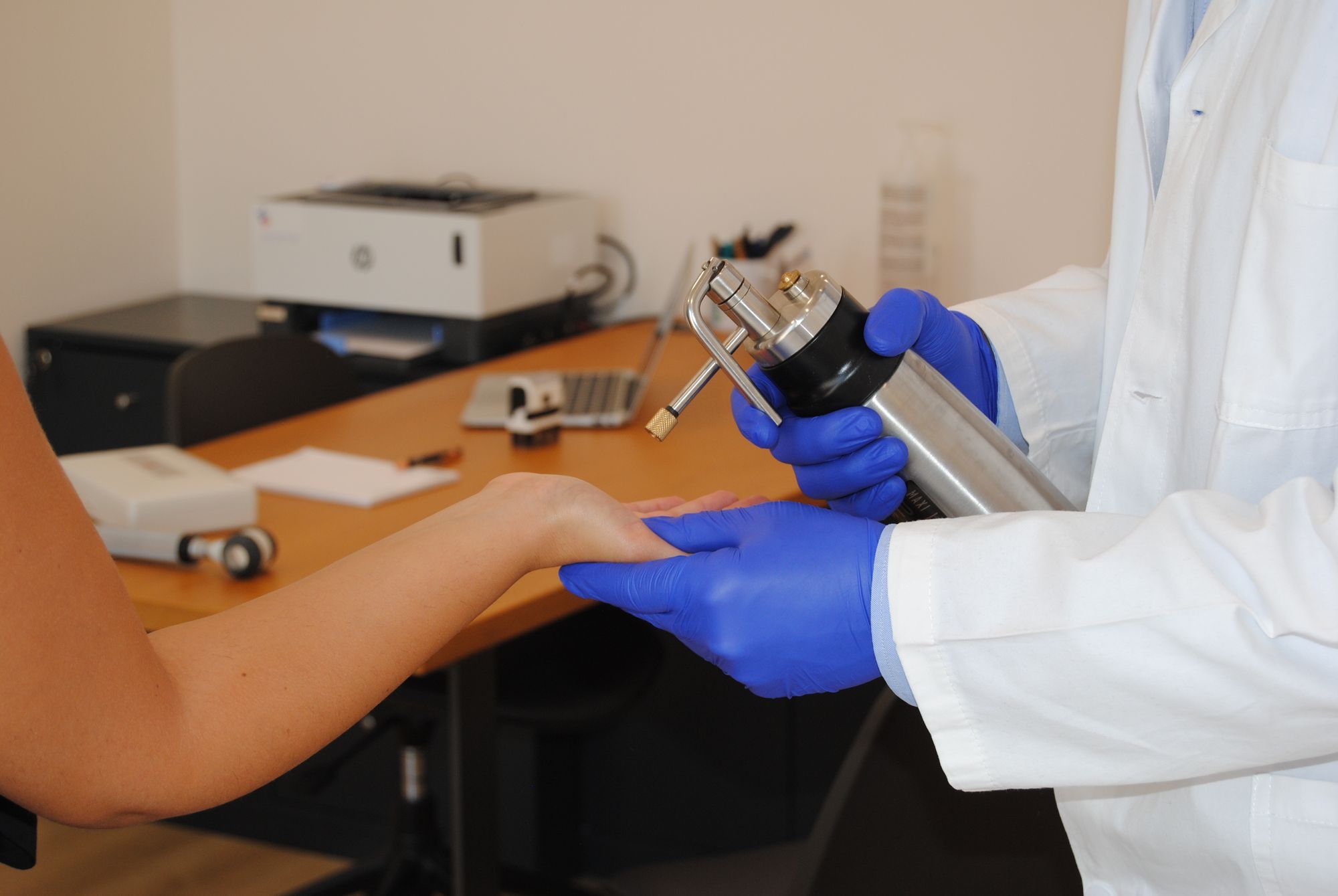 Trattamento di crioterapia in ambulatorio