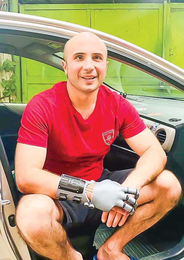 Giving Paralympians a hand