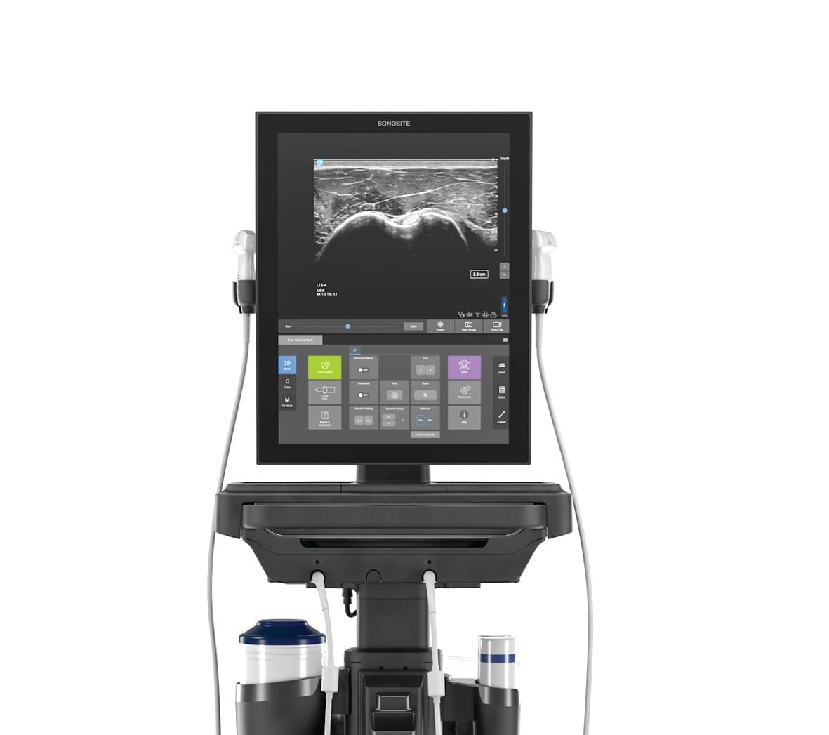 Operation ultrasound