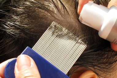 Outwitting the nits post image