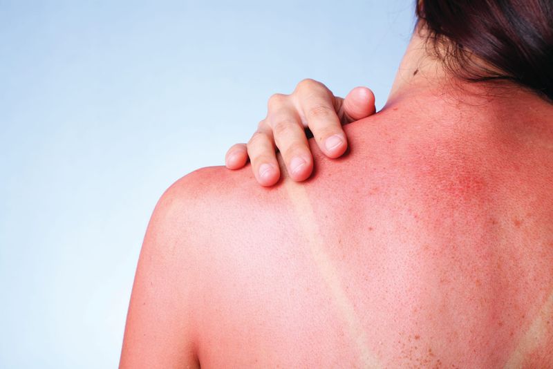 Don’t forget to slip, slop, slap this long weekend post image