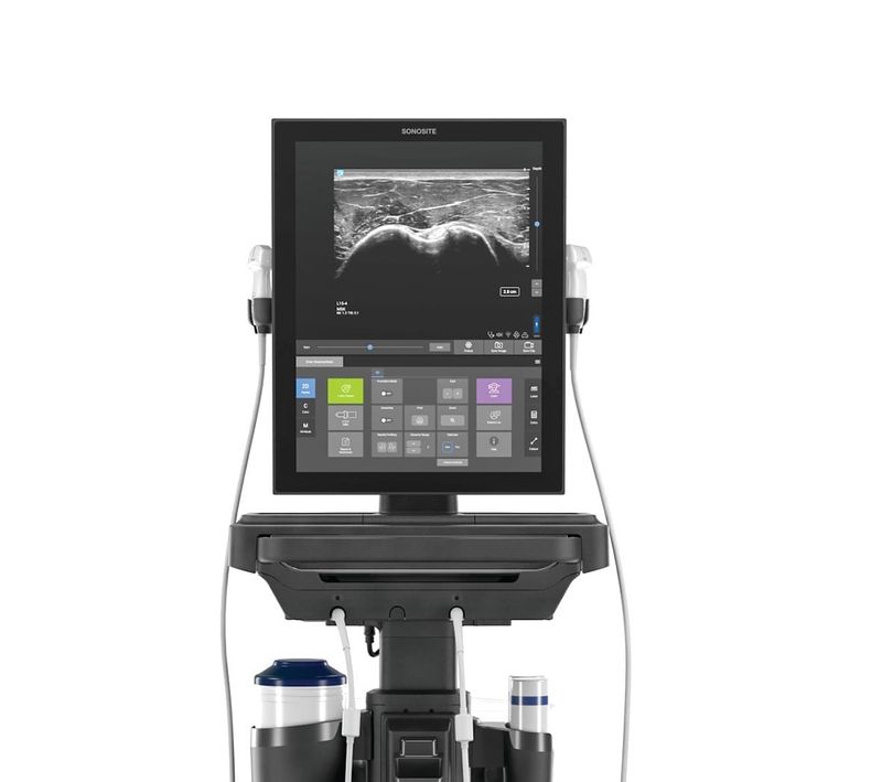 Operation ultrasound post image