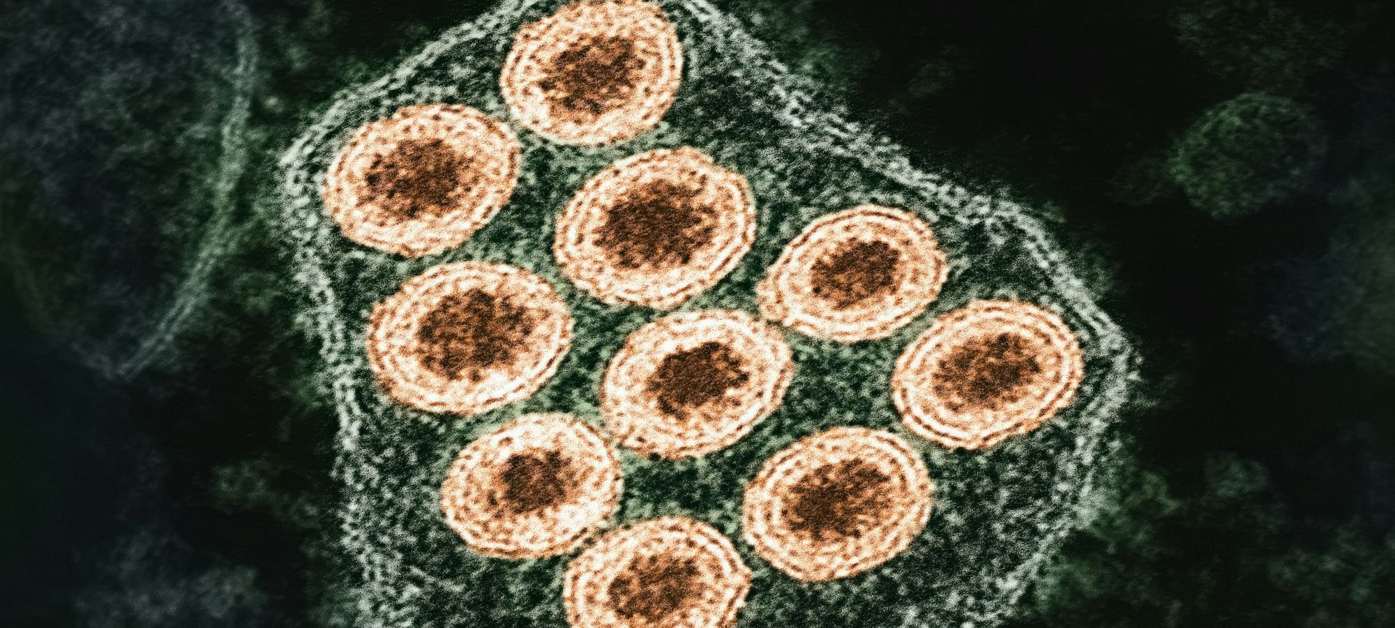 Ottawa County confirms first animal rabies case of 2026