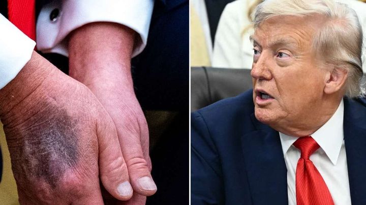 United States: Why Rumors About Donald Trump’s Health Are Growing