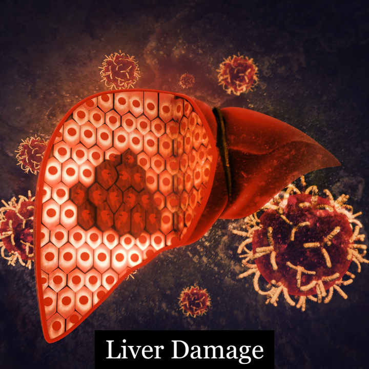 NAFLD the silent disease and your health