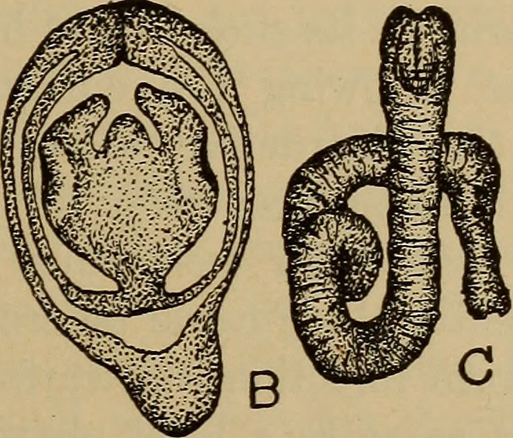 Beneath The Skin: The Alarming Reality of Parasitic Worms