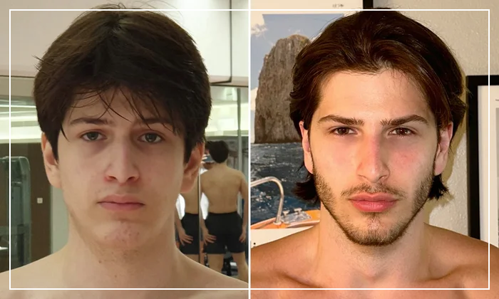 Mogging 101: How Should You Be Looksmaxxing?