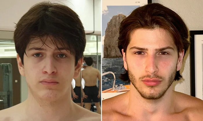 Mogging 101: How Should You Be Looksmaxxing?