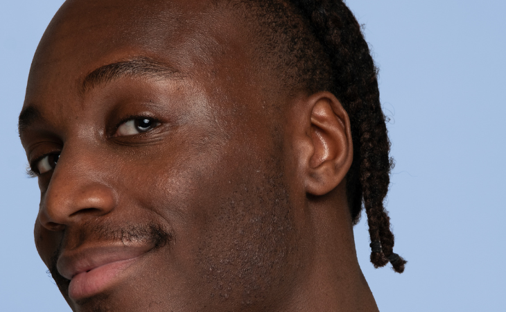 L'apparition des taches pigmentaires : comprendre et agir